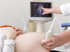 polip tijekom trudnoće