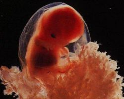 Фетус од 10 недеља трудноће