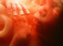 развој фетуса 13 14 недеља