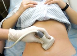 Pravděpodobnost otěhotnění po mimoděložním těhotenství