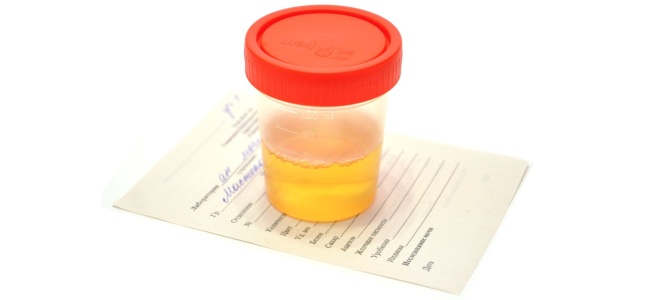 povzroča beljakovine v urinu otroka