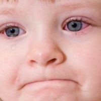 czerwone białka oczu dziecka