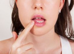 leczenie czerwonych płaskich porostów w jamie ustnej