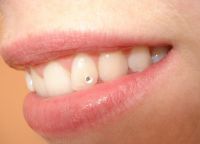 rhinestones na zubima 1