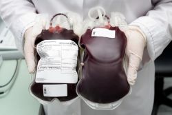 pravila transfuzije krvi in ​​njegove sestavine