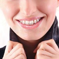 szafirowy system ortodontyczny