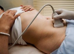 příznaky ovulace a ultrazvuku