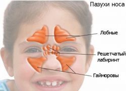 синуситис код симптома деце