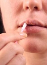 Как вылечить болячки на губах