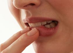 częste przyczyny zapalenia jamy ustnej