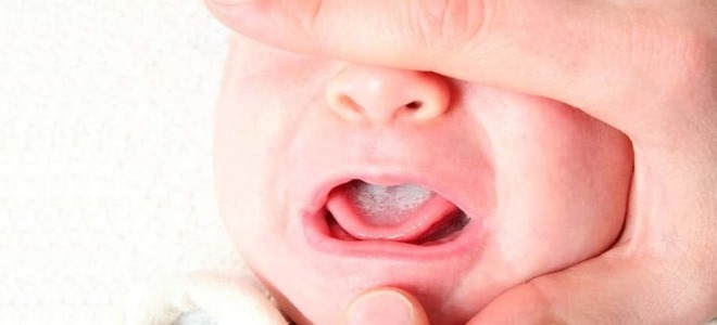 zapalenie jamy ustnej u dzieci