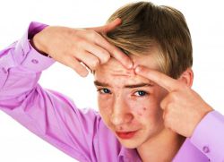 dospívající pimples u chlapců než léčených