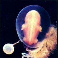 когато видите ембрион на узи
