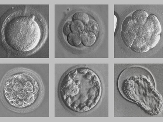 женски репродуктивни клетки
