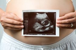 ultrazvok v prvem tednu nosečnosti