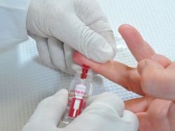 standardna dekodiranje testa krvi