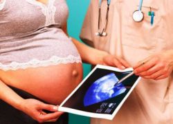 ultrazvuk v druhém trimestru těhotenství