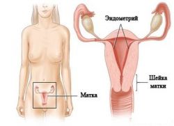 Debelina endometrija v menopavzi