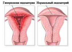размер на ендометриума по време на бременност