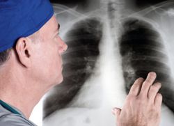 Napoved zdravljenja simptomov pljučnega embolija