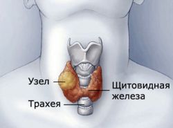 щитовидната болест при бременни жени
