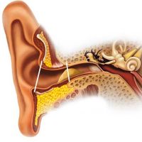 Vzroki žvepla v ušesih povzročajo