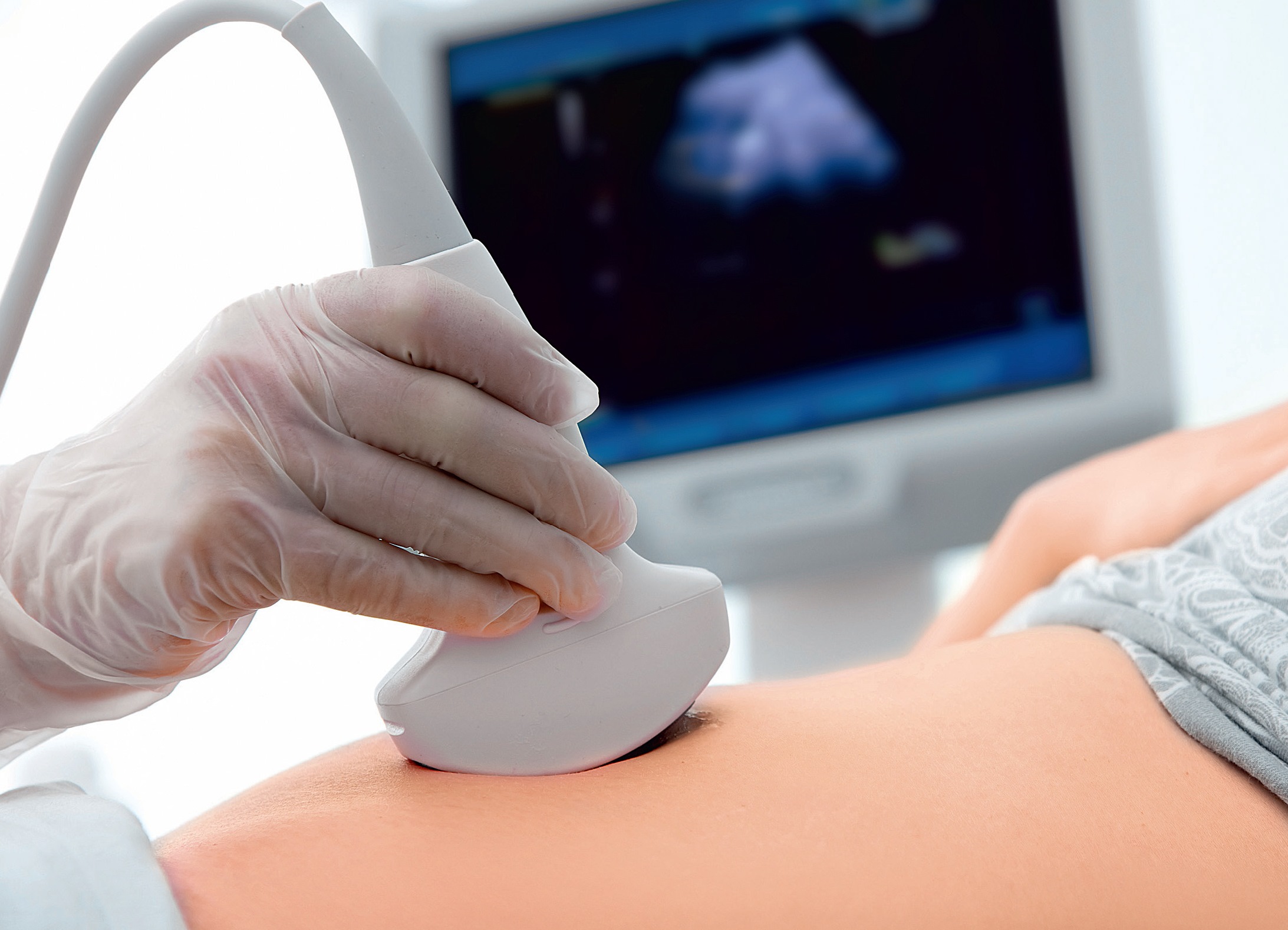 Ultrasound diagnostics