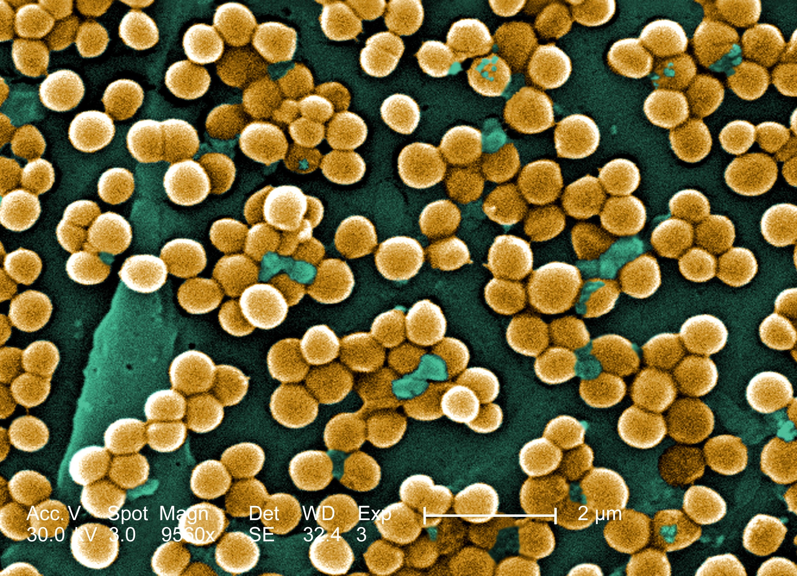 Стафилококк ауреус. Золотистый стафилококк MRSA. Метициллин-резистентный золотистый стафилококк. Бактерия золотистый стафилококк. Золотистый стафилококк под микроскопом.