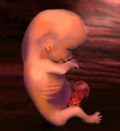 Малыш на 11 неделе. 11 Недель беременности фото плода. Эмбрион на 11 неделе беременности. Эмбрион 10 11 недель беременности. Фото плода 11 недель беременности фото.