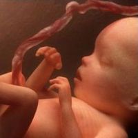 ultrazvuk v 20 týdnech těhotenství