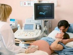 Tretji načrtovani ultrazvok med nosečnostjo