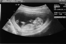 ultrazvuk 7 týdnů