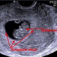 rani ultrazvuk