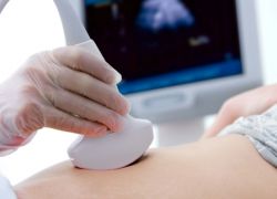 kdy je lepší udělat ultrazvukovou gynekologii