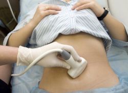 ultrazvuk s hidrokortizonskom mastom na donjem abdomenu