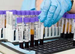 Norma močoviny pro krevní test
