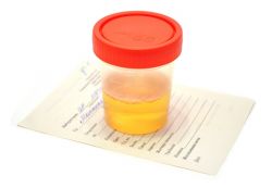 dekodiranje urinskih analiza tijekom trudnoće