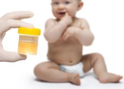 dekodiranje analize urina u normi djece