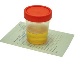 stopa urinskih oboljenja kod djece