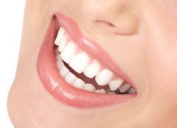 подравняване на зъбите с фурнир