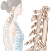 diagnóza vertebrální cervikální diagnostiky