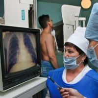 Ali rentgenski žarki kažejo pljučni rak?
