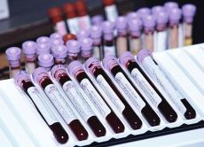 jaké testy krve dávají těhotné ženy
