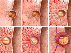 kada implantacija embrija odvija ovulacija