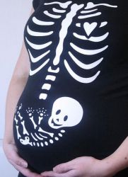 Възможно ли е бременни жени да направят флуорография