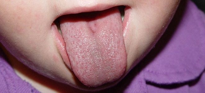 белый налет на языке у грудного ребенка