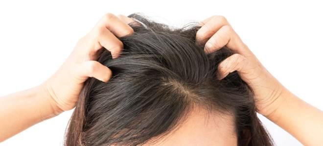 Почему болят корни волос на макушке