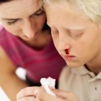 proč dítě často krvácí z nosních příčin
