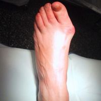 Rentgenový paprsek nohy se zátěží