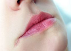 лечение на охлюви в ъглите на устата при възрастни